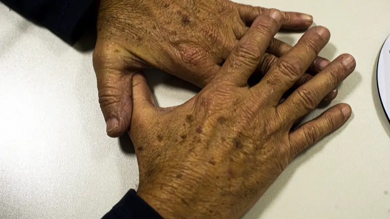 Brasil projeta 781 mil novos casos de câncer por ano até 2028